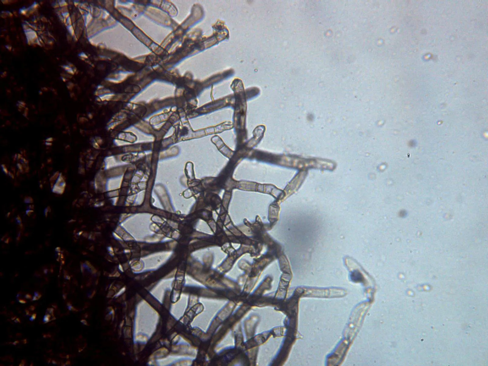 Microscopía de Rosellinia australiensis - 10 - Hifas conidiógenas 1 x 400